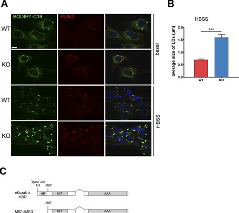 Microtubule Dependent And Independent Roles Of Spastin In Lipid Droplet