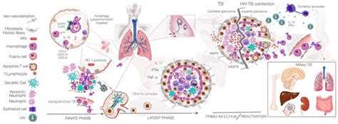 Microorganisms Free Full Text Hivmtb Co Infection From The