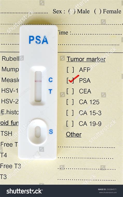 Psa Prostatespecific Antigen Testing By Using Stock Photo 292084571