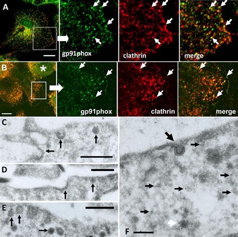 Immunofluorescence And Ultracryo Immunogold Em Shows Localization Of