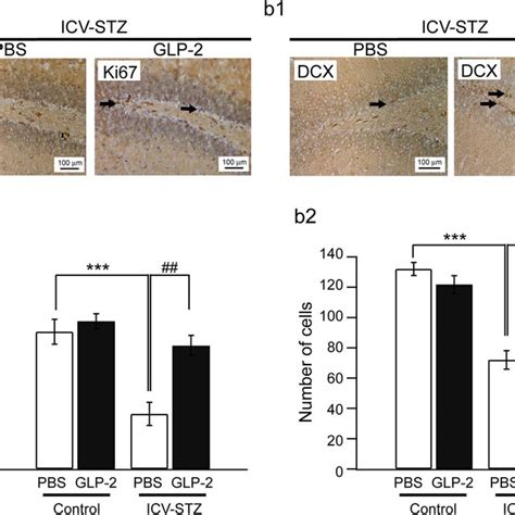 Effects Of Glp 2 On The Number Of Ki67 Positive Or Dcx Positive Cells Download Scientific