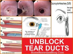 How to Clear Blocked Tear Duct in Babies and Adults Naturally - Home Remedies Blog