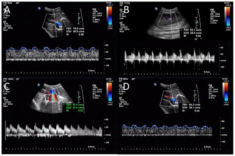 Representative Color Doppler Flow And Contrast Enhanced Ultrasound