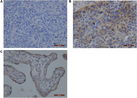 Prognostic Significance Of Epidermal Growth Factor Receptor And