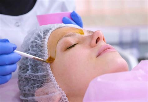 The Ultimate Guide To Chemical Peels St Louis Skin Solutions™