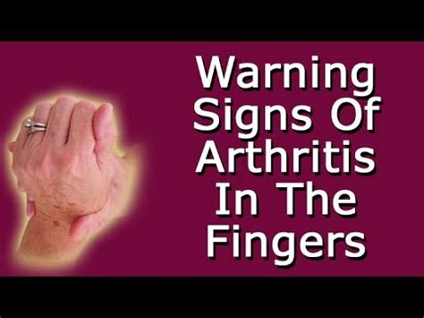 Warning Signs Of Arthritis In The Fingers - YouTube