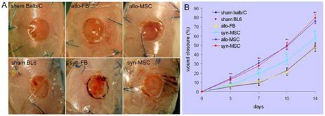 Effects Of Bm Mscs On Wound Closure A Excisional Wounds In