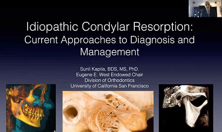 Idiopathic Condylar Resorption: Current Approaches to Diagnosis and ...