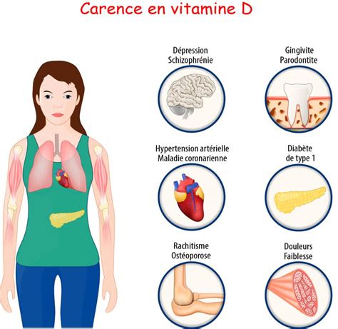 Vitamine D Carence Symptome DrBeckmann