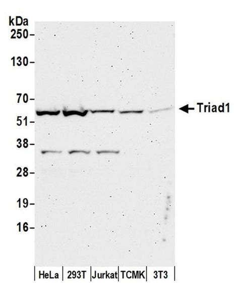 Triad1 Polyclonal Antibody A302 896a T