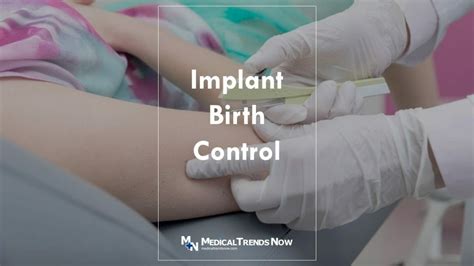 Implant Birth Control In The Philippines: Price, Removal, Pros and Cons ...