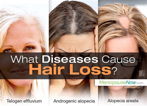 Hair Diseases And Hair Loss Menopause Now