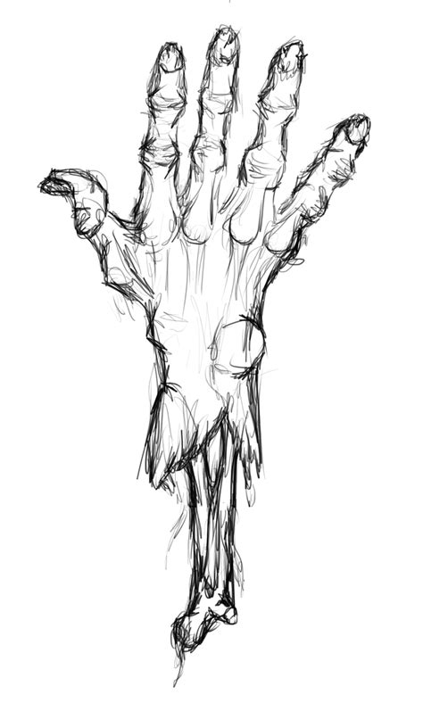 Severed Hand By Ictis97 On Deviantart