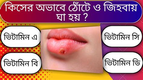 কন ভটমনর অভব ঠট ও জহবয ঘ হয gk quiz bangla mcq