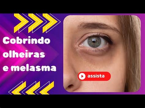 Camuflagem Para Olheiras E Melasma Tutorial Para Todos Os Tons De Pele