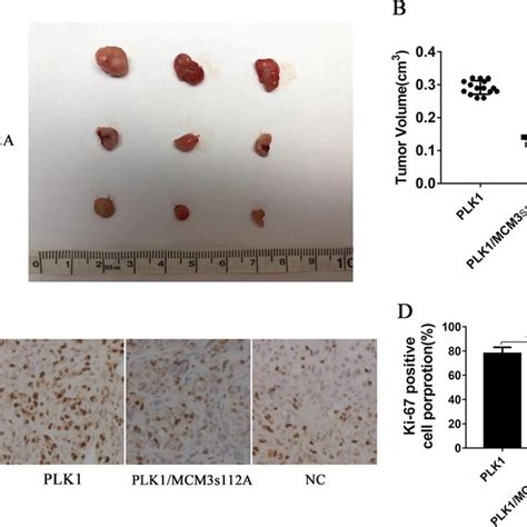 PLK1 Promotes RCC Proliferation And Suppresses Apoptosis Through