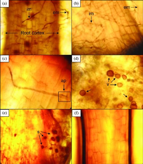 Mycorrhizal Structures Developed By Arbuscular Mycorrhizal Fungi AMF