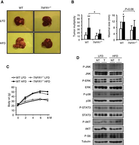 Dietary And Genetic Obesity Promote Liver Inflammation And Tumorigenesis By Enhancing Il 6 And