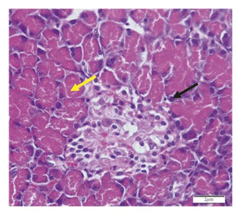 Histopathology Of The Pancreas In A The Normal Control Group B The