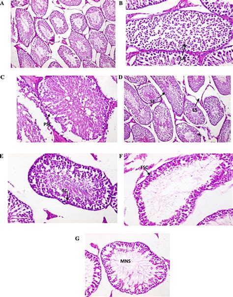 A Testicular Section Of Control Rats 100× B And C Testicular