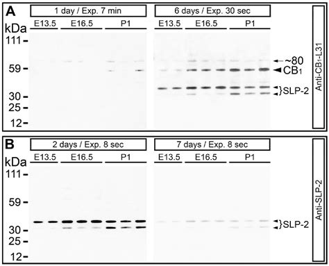 Figure 1 From Alteration Of Slp 2 Like Immunolabeling In Mitochondria