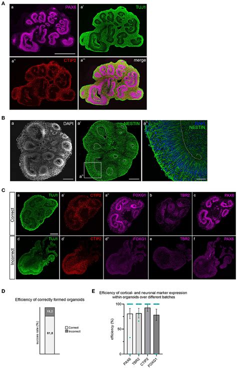 Frontiers A Simplified Protocol For The Generation Of Cortical Brain