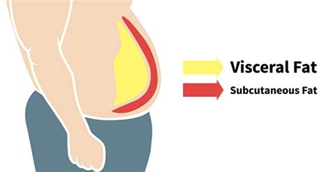 Stubborn Fat Everything You Need To Know Premier Clinic