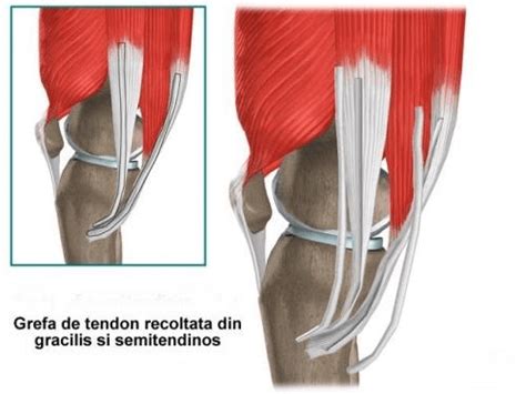 Ligament