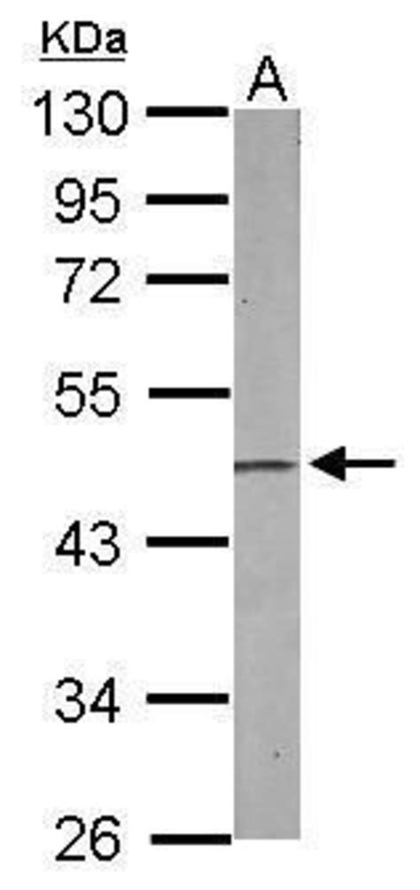 EBP1 Polyclonal Antibody Invitrogen 100 μL Unconjugated EBP1