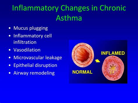 Ppt Pediatric Board Review Allergy Immunology Powerpoint