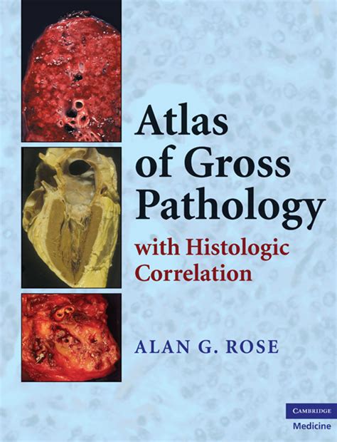 Atlas Of Gross Pathology