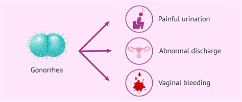 Gonorrhea Vaginal Discharge