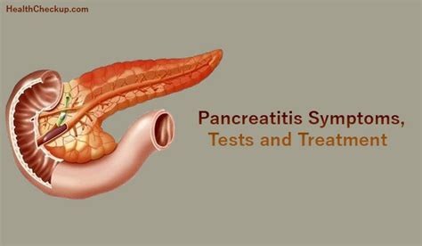 Pancreatitis Symptoms Treatment Diagnosis Types Of Pancreatitis