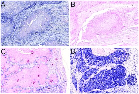 The Mir 21 In Situ Hybridization Is Specific Comparison Between The