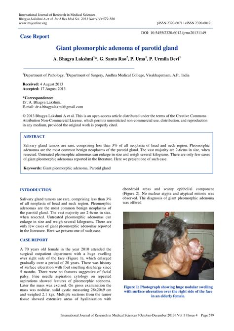 Pdf Giant Pleomorphic Adenoma Of Parotid Gland