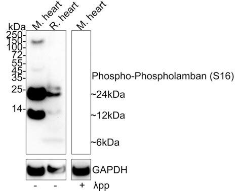 Phospho Phospholamban Ser16 Recombinant Monoclonal Antibody Je47 45