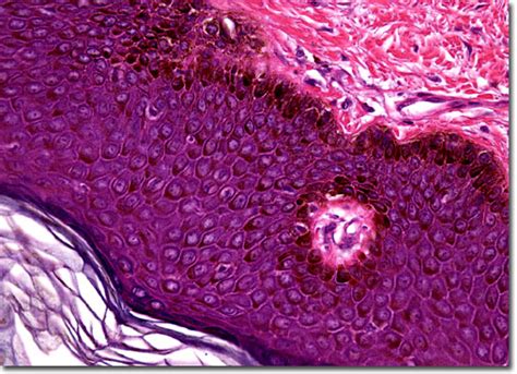 Molecular Expressions Microscopy Primer Anatomy Of The Microscope Brightfield Microscopy