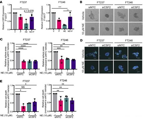 Jci Insight Norepinephrine Induces Anoikis Resistance In High Grade