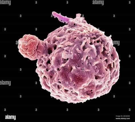 Neutrophil Engulfing Tb Bacteria Coloured Scanning Electron Micrograph