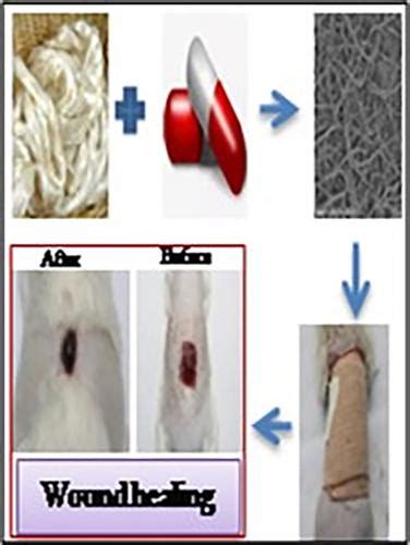 Silk Fibroin Electrospun Nanofiber Blends With Antibiotics And Polyvinyl Alcohol For Burn Wound