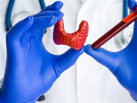 Blutwerte und was sie bedeuten