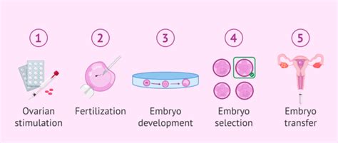 What Are Some Of The Main Advantages Of In Vitro Fertilization