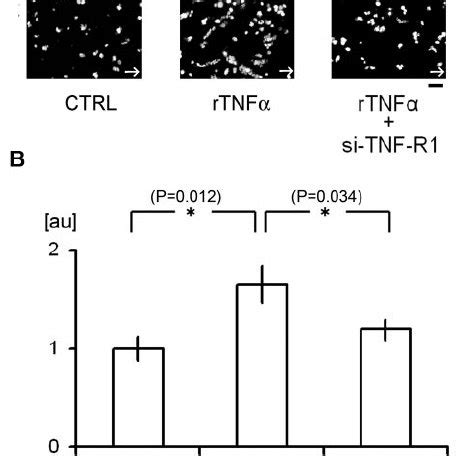 Flow Chamber Analysis Of The Contribution Of TNF Signaling To