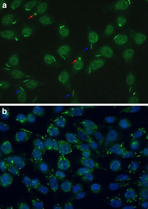 A Indirect Immunofluorescence Iif On Hep 2 Cells Of A Prototype Download Scientific Diagram