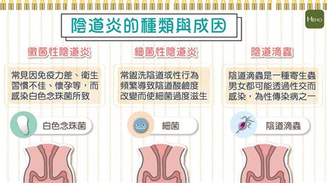 私密處出現搔癢、異味怎麼辦？3 種常見陰道炎種類有這些｜圖解健康動起來 Youtube