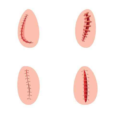 operando sutura íconos conjunto dibujos animados vector varios tipo de