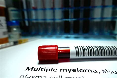 Immune System Plays Vital Role in Longer Multiple Myeloma Remission - InventUM