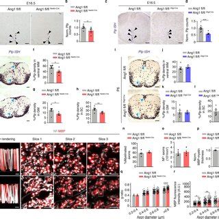 Impaired Ol Differentiation And Maturation In Neural Specific