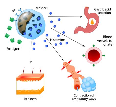 Histamine Intolerance And The Mold Injured Patient