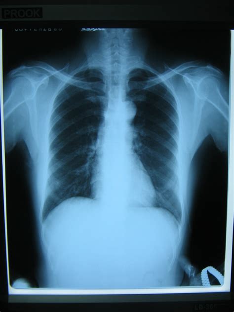 X Ray Film Medical Film X Ray Medical Film Radiology Film Medical